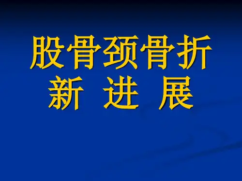股骨颈骨折新  进  展..