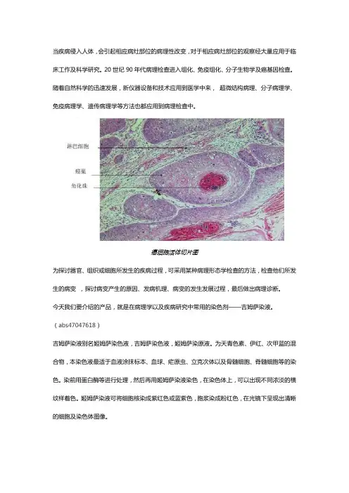 吉姆萨染液—病理切片常用染色方法