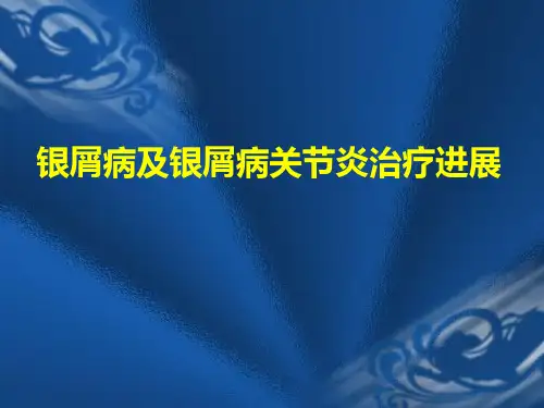 银屑病关节炎治疗-PPT课件