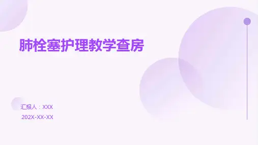 肺栓塞护理教学查房ppt