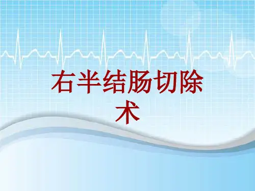 手术讲解模板：右半结肠切除术