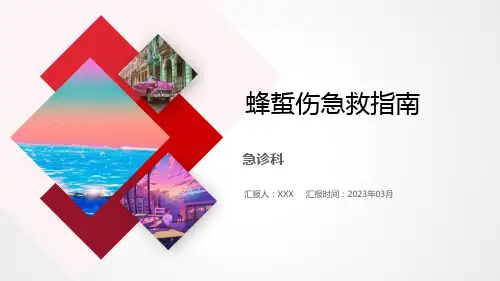 蜂蜇伤急诊救治指南