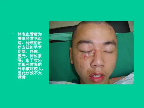 平阳霉素注射治疗体表血管瘤