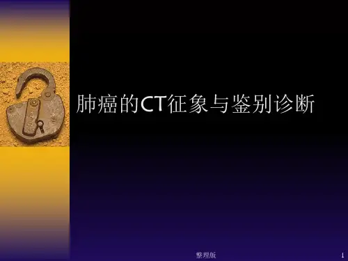 肺癌CT诊断
