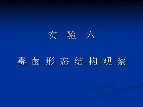 实验六 霉菌形态结构观察