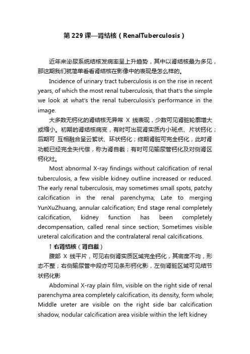 第229课—肾结核（RenalTuberculosis）