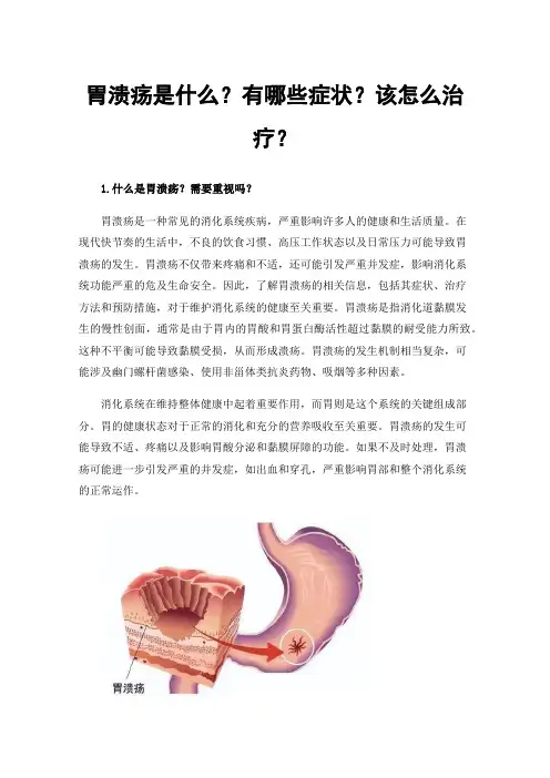 胃溃疡是什么？有哪些症状？该怎么治疗？