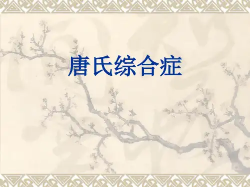 V唐氏综合症(200910)