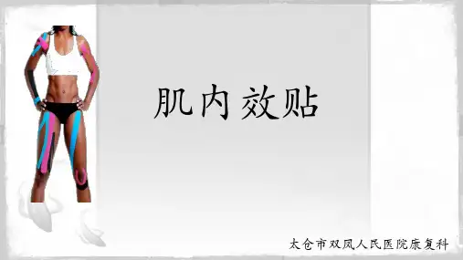 肌内效贴技术