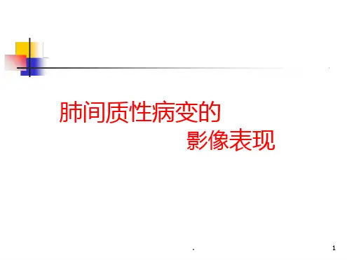 肺间质性病变的影像表现ppt课件