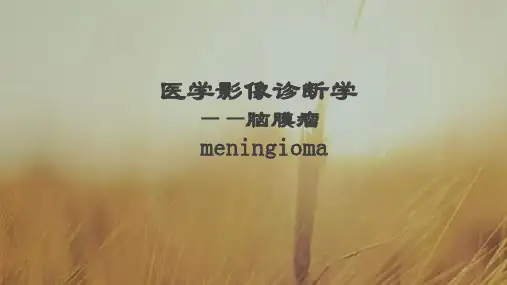 脑膜瘤的影像诊断PPT课件
