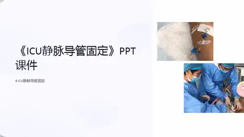 《ICU静脉导管固定》课件