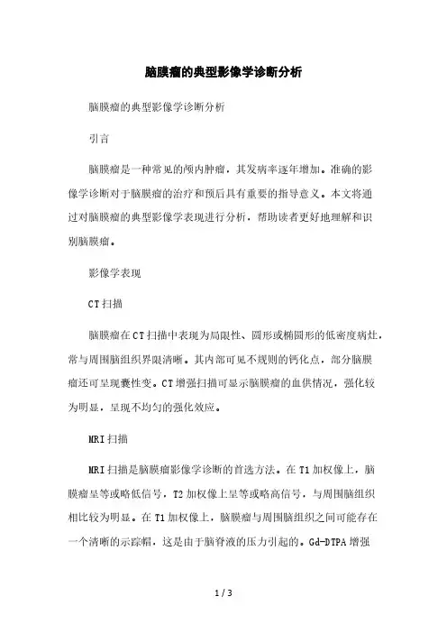 脑膜瘤的典型影像学诊断分析本月修正版