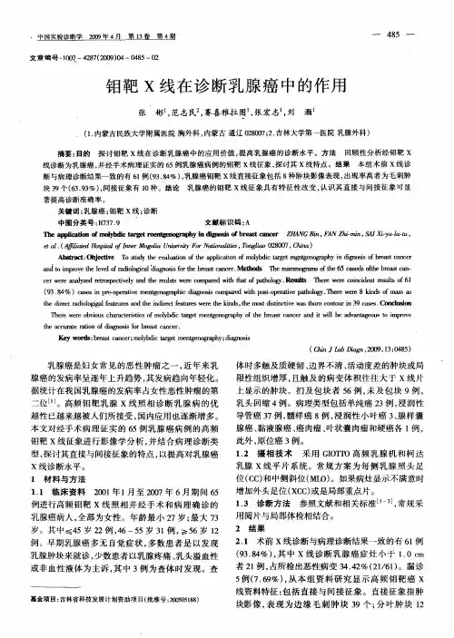 钼靶X线在诊断乳腺癌中的作用