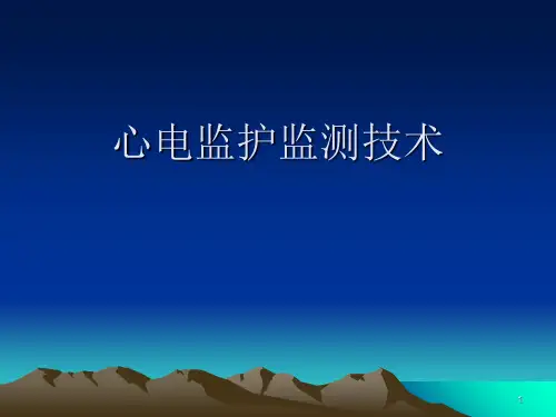 心电监护监测技术PPT课件
