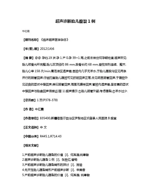 超声诊断胎儿腹裂1例
