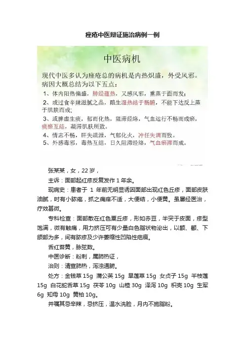 痤疮中医辩证施治病例一例