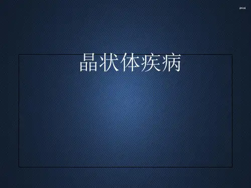 晶状体疾病  ppt课件