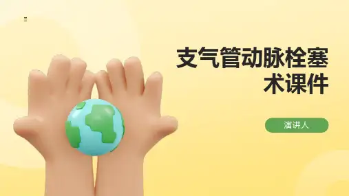 支气管动脉栓塞术课件