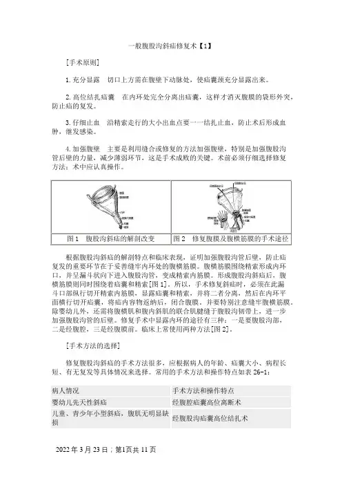 一般腹股沟斜疝修复术手术图谱