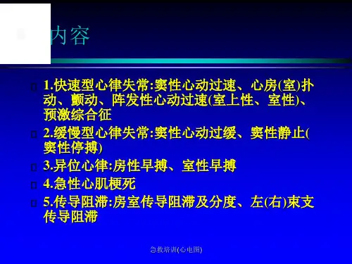 急救培训心电图课件