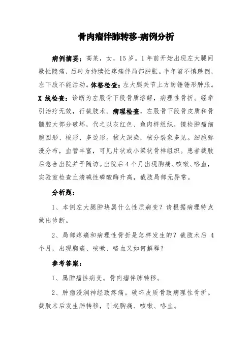 骨肉瘤伴肺转移-病例分析