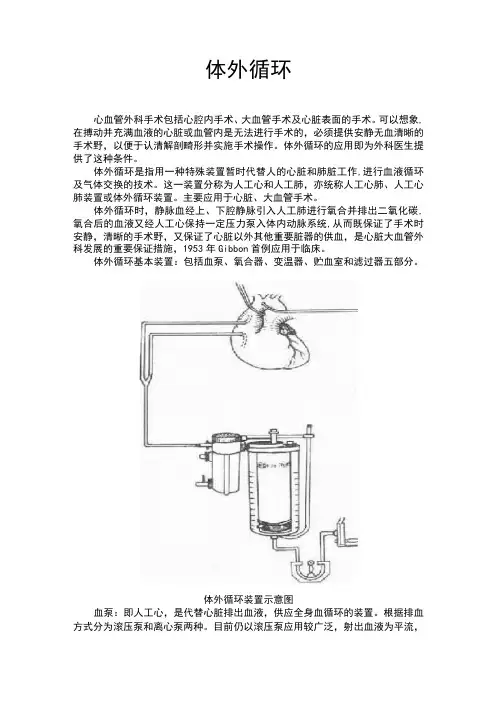(完整版)体外循环