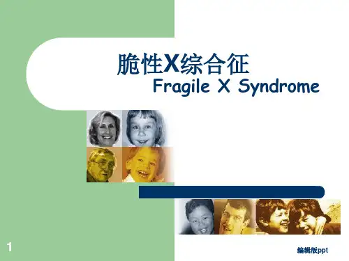 脆性X综合征医学PPT