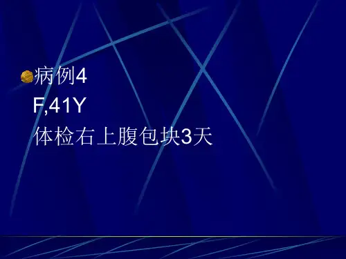 巨淋巴结增生症