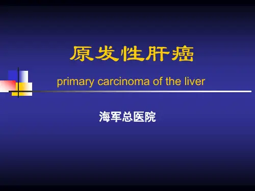 原发性肝癌(丁华)