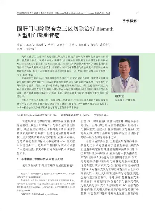 围肝门切除联合左三区切除治疗BismuthⅣ型肝门部胆管癌