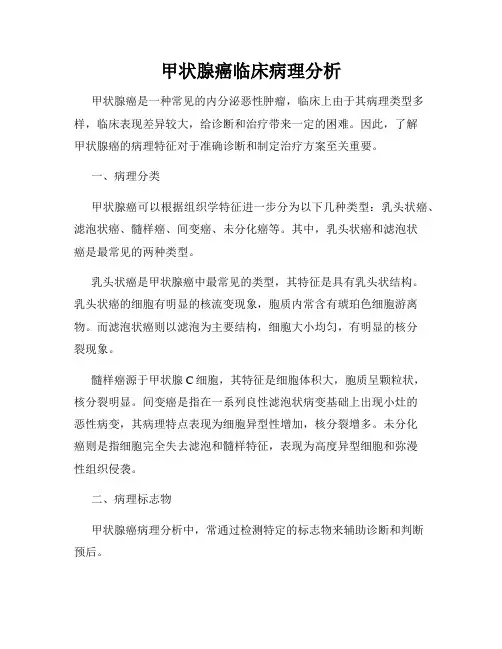 甲状腺癌临床病理分析