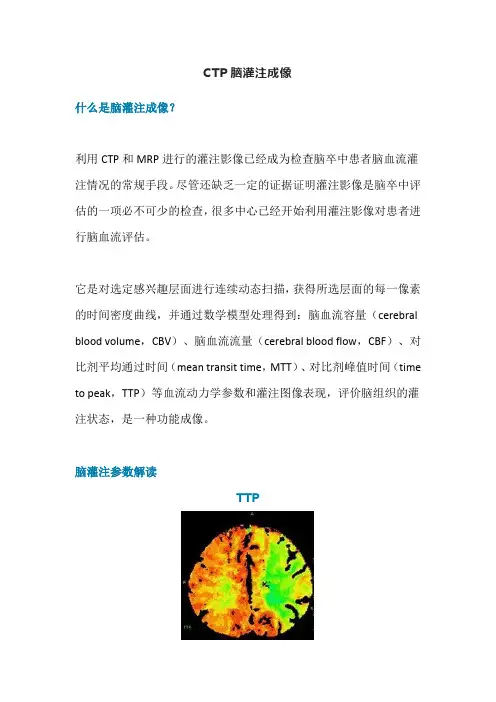 CTP脑灌注成像
