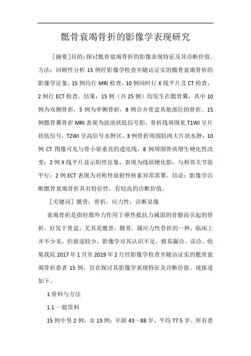 骶骨衰竭骨折的影像学表现研究