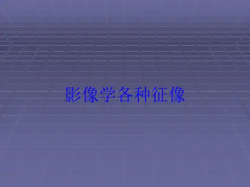 影像学各种征像培训课件