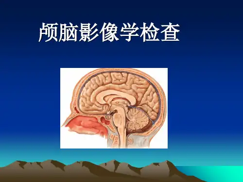 脑血管病的影像学检查PPT课件