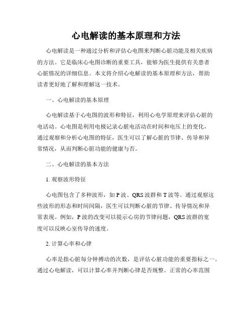 心电解读的基本原理和方法