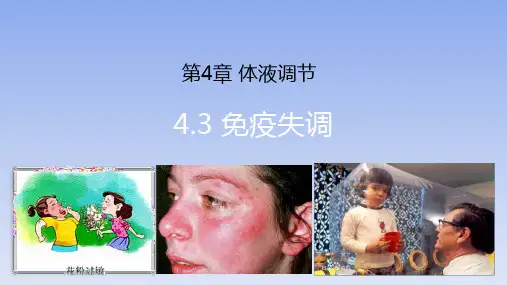【课件】免疫失调课件+2022——2023学年高二上学期生物人教版选择性必修1