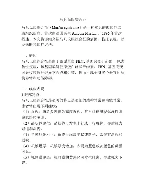 马凡氏眼综合征