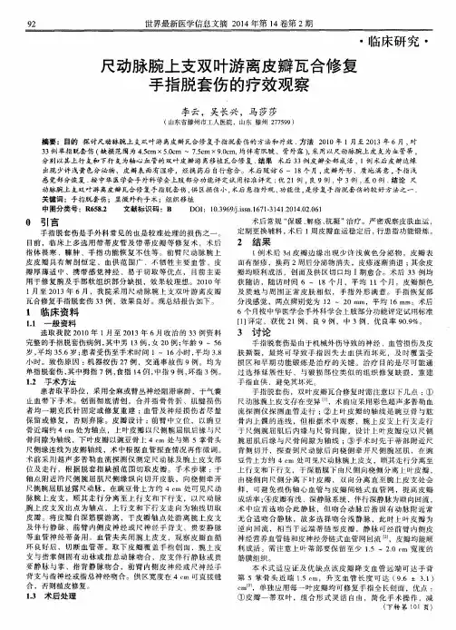 尺动脉腕上支双叶游离皮瓣瓦合修复手指脱套伤的疗效观察