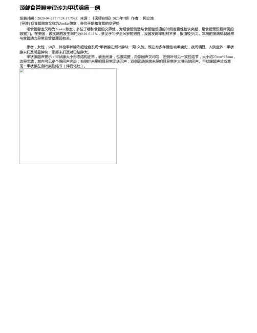 颈部食管憩室误诊为甲状腺癌一例