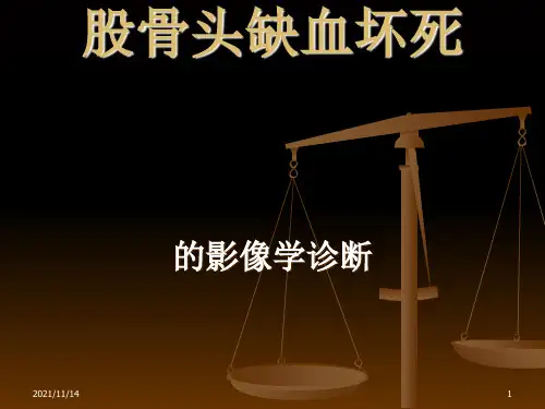 股骨头坏死的影像学诊断