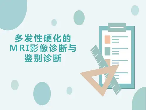 多发性硬化的MRI影像诊断与鉴别诊断
