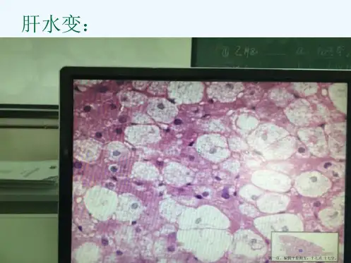 病理学实验切片考试图片