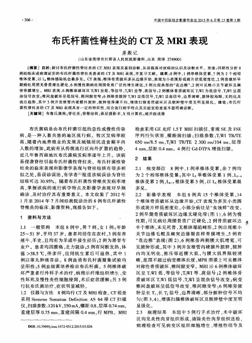 布氏杆菌性脊柱炎的CT及MRI表现