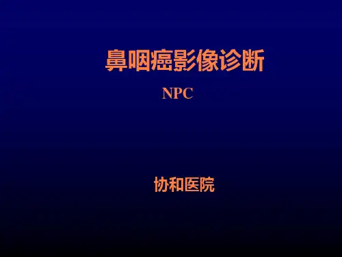 鼻咽癌影响诊断及咽旁间隙解剖及分期ppt课件