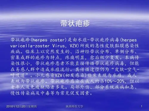带状疱疹