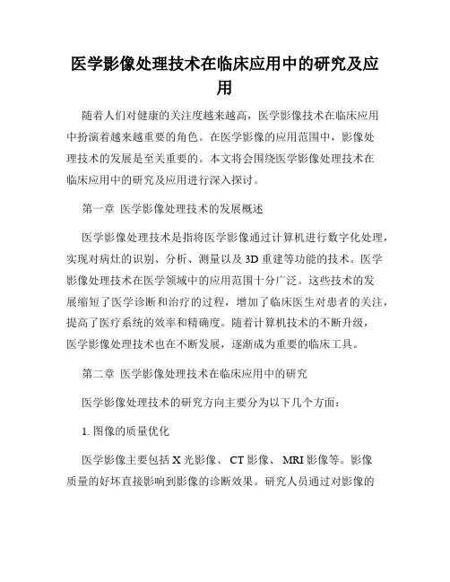 医学影像处理技术在临床应用中的研究及应用