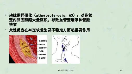 动脉粥样硬化与炎症课件