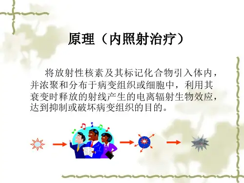 I131治疗甲亢